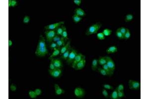 Immunofluorescence staining of HepG2 cells with ABIN7166030 at 1:133, counter-stained with DAPI. (S1A1 (AA 2-94) Antikörper)