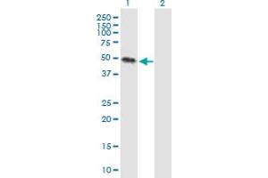 Western Blot analysis of KREMEN2 expression in transfected 293T cell line by KREMEN2 MaxPab polyclonal antibody. (KREMEN2 Antikörper  (AA 1-420))