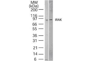Image no. 1 for anti-Interleukin-1 Receptor-Associated Kinase 1 (IRAK1) (AA 700-712) antibody (ABIN208558) (IRAK1 Antikörper  (AA 700-712))