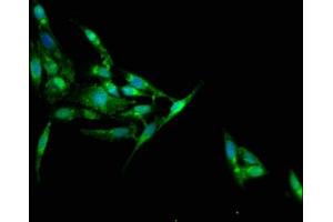 Immunofluorescence staining of Hela cells with ABIN7157178 at 1:100, counter-stained with DAPI. (Junctophilin 1 Antikörper  (AA 431-546))