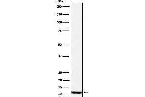 Western blot analysis of SPINK1 expression in Human pancreas lysate.