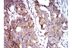 Immunohistochemistry (IHC) image for anti-BCL2/adenovirus E1B 19kDa Interacting Protein 3 (BNIP3) (AA 50-155) antibody (ABIN5858883) (BNIP3 Antikörper  (AA 50-155))
