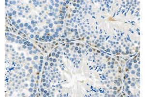 ABIN6263540 and ABIN6279810 at 1/100 staining Mouse testis tissue by IHC-P. (NCKIPSD Antikörper  (Internal Region))