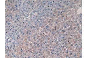IHC-P analysis of Mouse Liver Tissue, with DAB staining. (IL-2 Antikörper  (AA 10-169))
