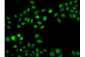 Immunofluorescence analysis of A549 cell using SULT2B1 antibody. (SULT2B1 Antikörper)