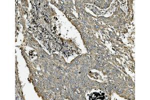 IHC analysis of NDUFB10 using anti-NDUFB10 antibody (ABIN7601461).