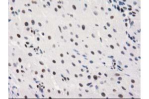 Immunohistochemical staining of paraffin-embedded Human Ovary tissue using anti-MEF2C mouse monoclonal antibody. (MEF2C Antikörper)