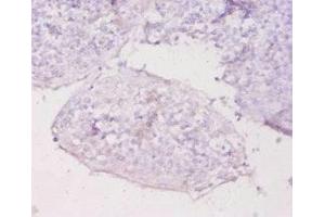 Immunohistochemistry of paraffin-embedded human tonsil tissue using ABIN7159517 at dilution of 1:20 (MT1E Antikörper  (AA 4-59))