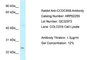 Western Blotting (WB) image for anti-Coiled-Coil Domain Containing 85B (CCDC85B) (N-Term) antibody (ABIN2789085) (CCDC85B Antikörper  (N-Term))