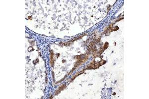 IHC analysis of SUMF2 using anti-SUMF2 antibody (ABIN7600954). (SUMF2 Antikörper  (AA 26-301))