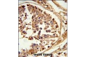 Formalin-fixed and paraffin-embedded human testis tissue reacted with LIPE Antibody (C-term) (ABIN653323 and ABIN2842814) , which was peroxidase-conjugated to the secondary antibody, followed by DAB staining. (LIPE Antikörper  (C-Term))