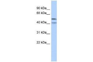 Western Blot showing ZNF566 antibody used at a concentration of 1-2 ug/ml to detect its target protein. (ZNF566 Antikörper  (Middle Region))