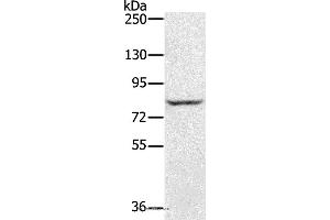 Western blot analysis of Jurkat cell, using RNF43 Polyclonal Antibody at dilution of 1:300 (RNF43 Antikörper)
