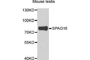 Western blot analysis of extracts of mouse testis, using SPAG16 antibody. (SPAG16 Antikörper)