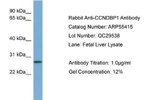 WB Suggested Anti-CCNDBP1  Antibody Titration: 0.