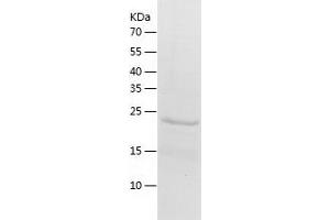 Western Blotting (WB) image for Suppressor of Cytokine Signaling 1 (SOCS1) (AA 1-212) protein (His tag) (ABIN7125254) (SOCS1 Protein (AA 1-212) (His tag))
