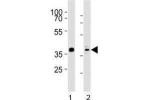 Western blot analysis of lysate from mouse stomach, rat heart tissue (left to right) using Mouse Nkx2. (NK2 Homeobox 5 Antikörper  (AA 192-225))