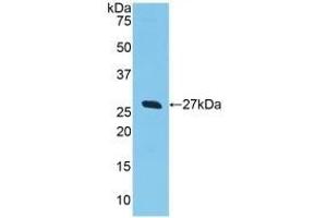 Detection of Recombinant GSTa2, Human using Polyclonal Antibody to Glutathione S Transferase Alpha 2 (GSTa2) (GSTa2 Antikörper  (AA 1-222))
