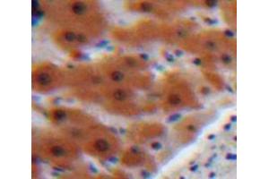 Used in DAB staining on fromalin fixed paraffin-embedded Liver tissue (AGT Antikörper  (AA 23-477))