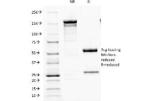 SDS-PAGE Analysis Purified PTH Mouse Monoclonal Antibody (PTH/1173). (PTH Antikörper  (AA 32-115))