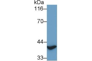 Detection of TITF1 in Rat Heart lysate using Polyclonal Antibody to Thyroid Transcription Factor 1 (TITF1) (NKX2-1 Antikörper)