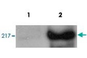 HeLa cells were transfected with CHD5 and analysed by Western blot.