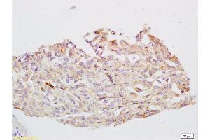 Immunohistochemistry (Paraffin-embedded Sections) (IHC (p)) image for anti-Cytochrome P450, Family 24, Subfamily A, Polypeptide 1 (CYP24A1) (AA 351-450) antibody (ABIN750838)