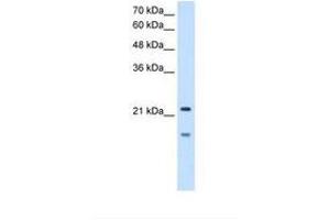 Image no. 1 for anti-Matrix Metallopeptidase 7 (Matrilysin, Uterine) (MMP7) (C-Term) antibody (ABIN321032)