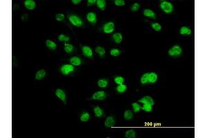 Immunofluorescence of monoclonal antibody to SIX4 on HeLa cell. (SIX4 Antikörper  (AA 672-780))