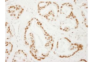Immunohistochemistry (IHC) image for anti-Activated RNA Polymerase II Transcriptional Coactivator p15 (SUB1) (AA 77-127) antibody (ABIN7448719)