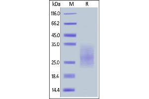 Human CD28H, His Tag on  under reducing (R) condition.