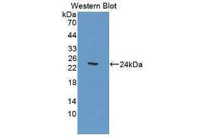 Western blot analysis of the recombinant protein. (CNDP1 Antikörper  (AA 332-507))