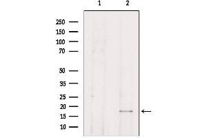 Western blot analysis of extracts from HepG2, using TP53I11 Antibody. (TP53I11 Antikörper  (N-Term))