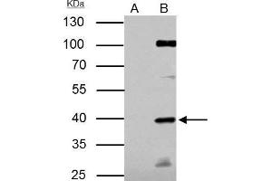 IP Image E2F1 antibody [N1N3] immunoprecipitates E2F1 protein in IP experiments.