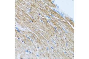Immunohistochemistry of paraffin-embedded mouse heart using CCL2 antibody at dilution of 1:100 (40x lens). (CCL2 Antikörper)