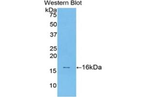 Detection of Recombinant TGFb1, Rat using Polyclonal Antibody to Transforming Growth Factor Beta 1 (TGFb1) (TGFB1 Antikörper  (AA 279-390))