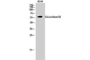 Western Blotting (WB) image for anti-Glucosidase, beta (Bile Acid) 2 (GBA2) (Internal Region) antibody (ABIN3175282) (GBA2 Antikörper  (Internal Region))