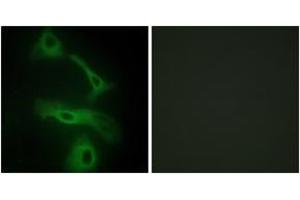 Immunofluorescence analysis of HeLa cells, using CLUS Antibody. (Clusterin Antikörper  (AA 400-449))