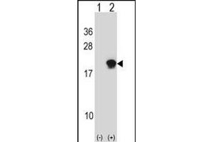 Western blot analysis of SUMO4 (arrow) using rabbit polyclonal SUMO4 Antibody (Center) (ABIN388077 and ABIN2845831). (SUMO4 Antikörper)