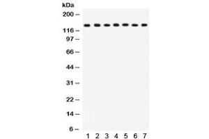 Western blot testing of 1) rat lung, 2) mouse lung, 3) HeLa, 4) MM231, 5) COLO320, 6) A549 and 7) mouse NIH3T3 lysate with SAP97 antibody. (DLG1 Antikörper  (AA 1-165))