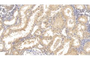 Detection of HRG in Human Kidney Tissue using Monoclonal Antibody to Histidine Rich Glycoprotein (HRG)