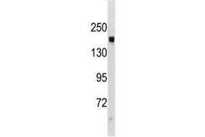 TSC1 antibody western blot analysis in mouse liver tissue lysate