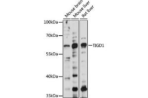 Western blot analysis of extracts of various cell lines, using TIGD1 antibody (ABIN7270828) at 1000 dilution. (TIGD1 Antikörper  (AA 1-300))