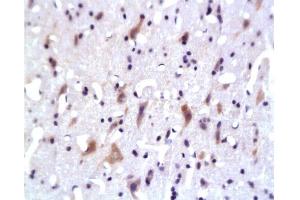 Formalin-fixed and paraffin embedded: rat brain tissue labeled with Anti-PKB Polyclonal Antibody, Unconjugated 1:200 followed by conjugation to the secondary antibody and DAB staining (AKT1/3 (AA 401-479) Antikörper)