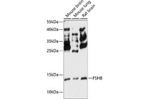 Western blot analysis of extracts of various cell lines, using FSHB antibody (ABIN7267225) at 1:3000 dilution. (FSHB Antikörper  (AA 19-129))