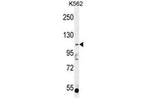 AGBL5 Antibody (N-term) western blot analysis in K562 cell line lysates (35µg/lane). (AGBL5 Antikörper  (N-Term))