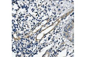 IHC analysis of CD31/PECAM1 using anti-CD31/PECAM1 antibody (ABIN7601076). (CD31 Antikörper  (AA 28-382))