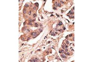 Image no. 2 for anti-Melanoma Antigen Family H, 1 (MAGEH1) (C-Term) antibody (ABIN358661) (MAGEH1 Antikörper  (C-Term))