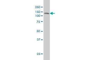 LAMB3 monoclonal antibody (M01), clone 2G10 Western Blot analysis of LAMB3 expression in A-431 . (Laminin beta 3 Antikörper  (AA 1064-1171))