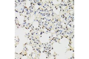 Immunohistochemistry of paraffin-embedded mouse lung using KDM4A antibody (ABIN6131821, ABIN6142793, ABIN6142795 and ABIN6223960) at dilution of 1:100 (40x lens). (KDM4A Antikörper  (AA 585-815))